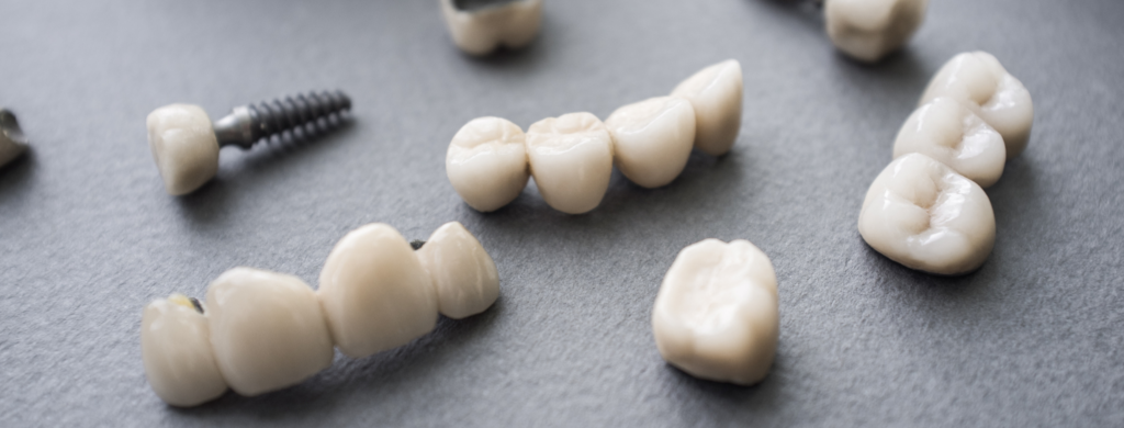 Dental Crowns at Meng Dentistry