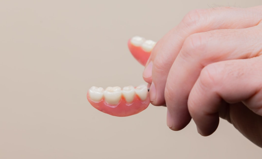 Denture Implants at Meng Dentistry